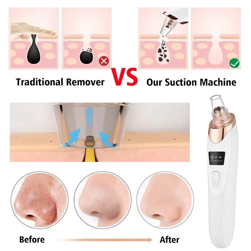 Electric Blackhead Remover USB Face Deep Cleansing Pore Beauty Machine Dead Skin Remover Face Vacuum Blackhead Removal Skin Care